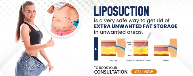 Liposuction in Mumbai at an Affordable cost