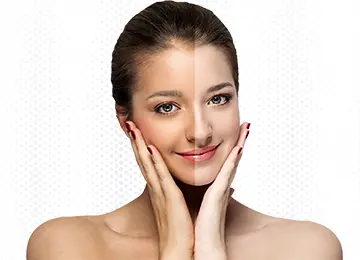 Skin Whitening