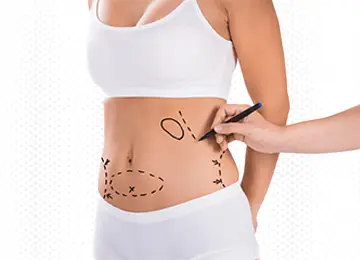 Liposuction Surgery