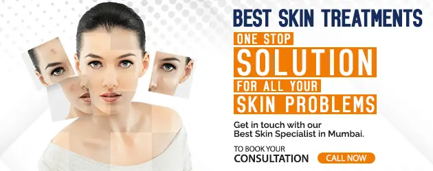 Best Skin Specialist in Mumbai
