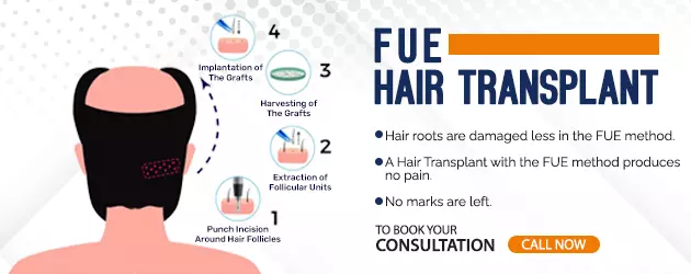 fue hair transplant in mumbai