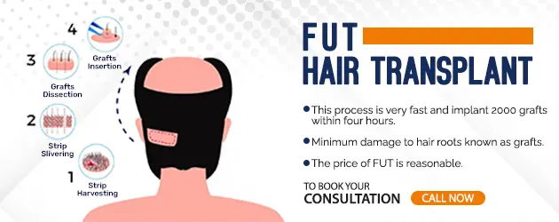 fue hair transplant in mumbai