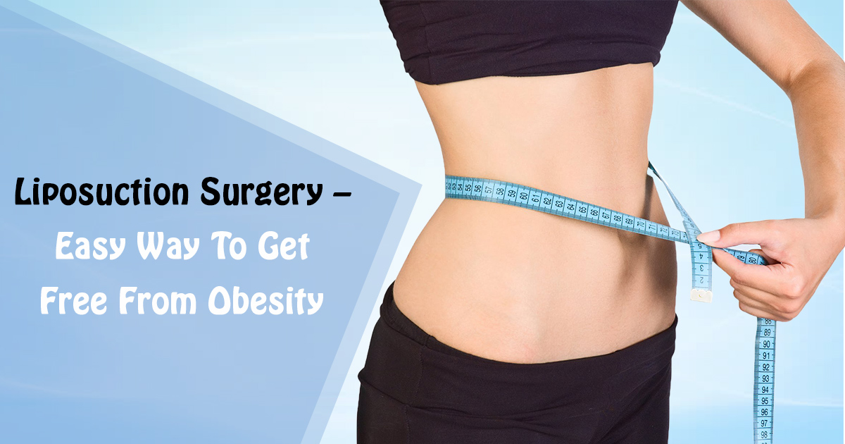Liposuction Surgery
