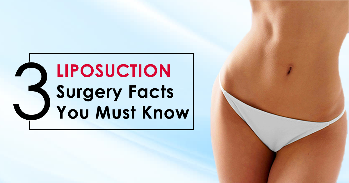 3 Liposuction Surgery Facts You Must Know
