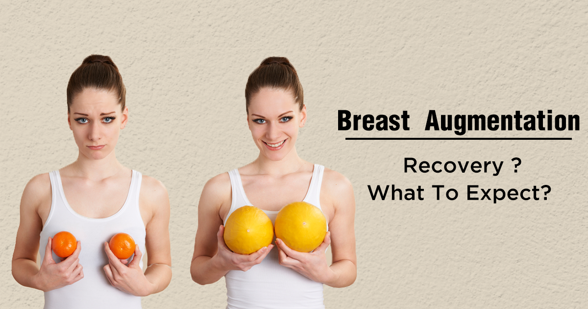 Breast Augmentation