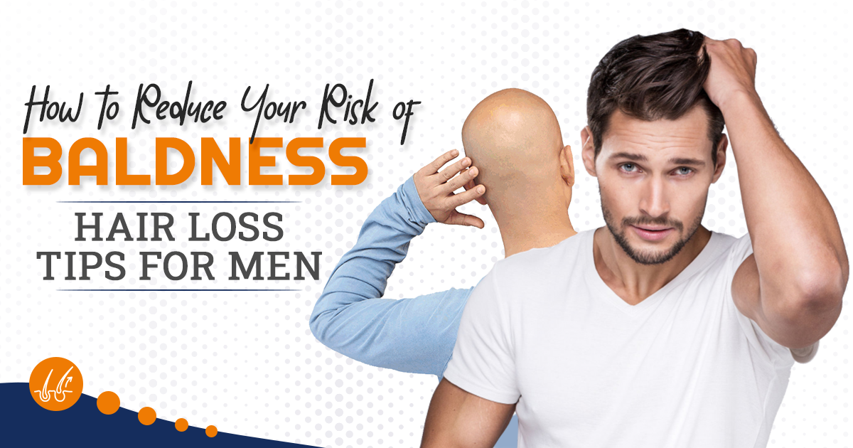 How to Reduce Your Risk of Baldness | Hair Loss Tips for Men