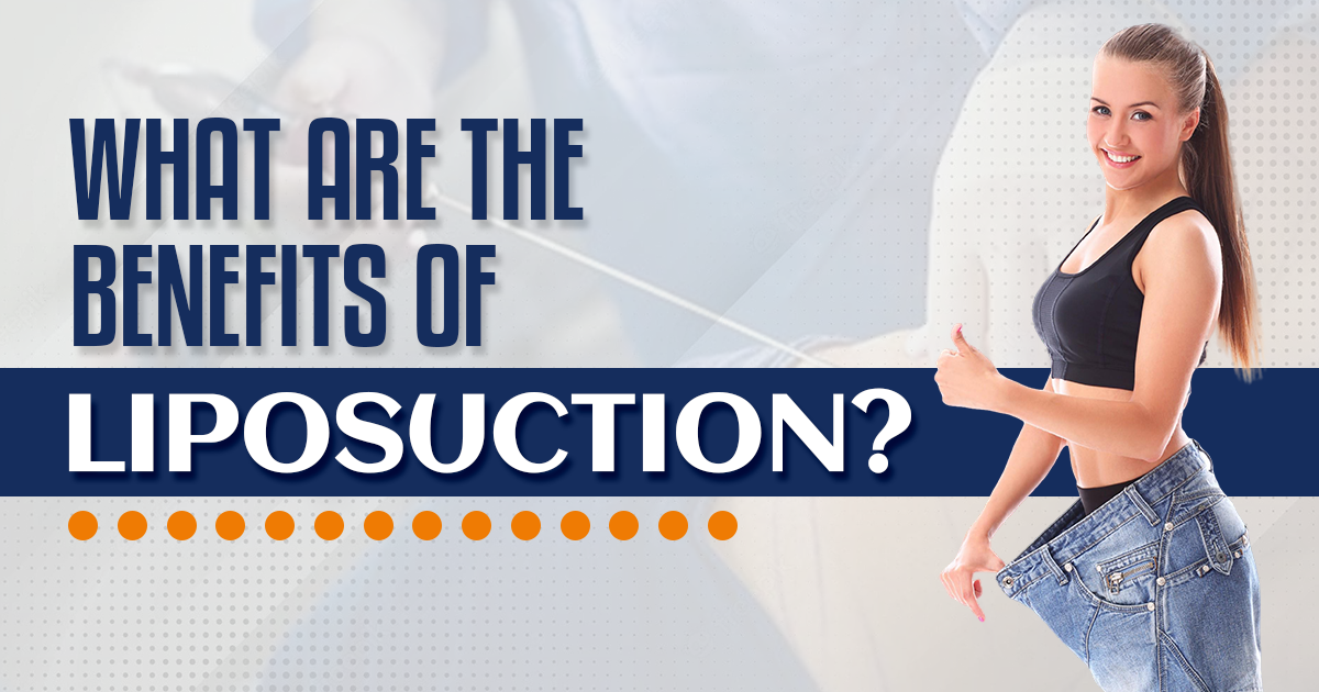 What are the Benefits of Liposuction?