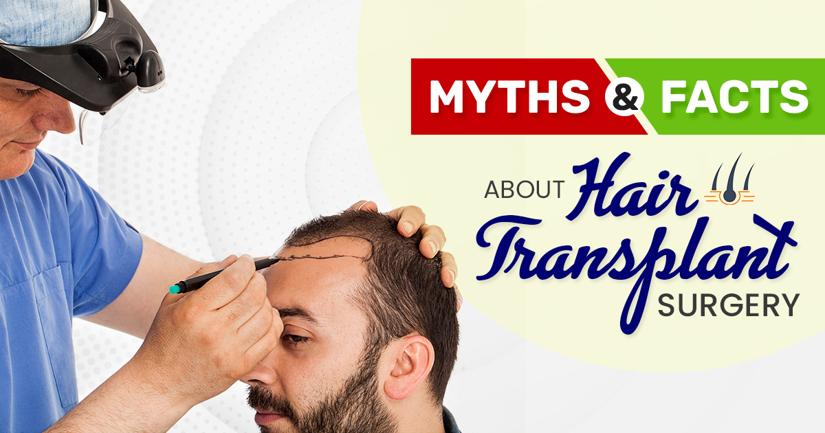 Myths and Facts about Hair Transplant Surgery